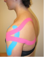 foto Kinesiotaping