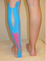 foto Kinesiotaping